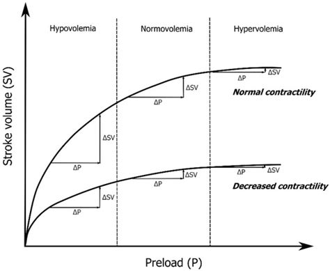 Novel Methods for Predicting Fluid Responsiveness in Critically Ill ...