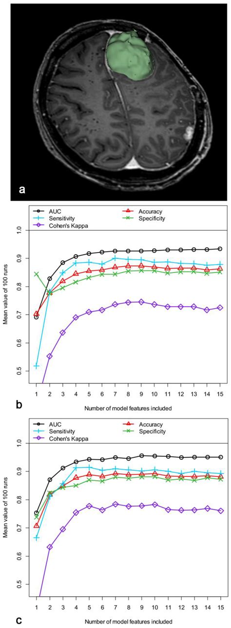 Radiomics-Based Prediction of TERT Promotor Mutations in Intracranial ...