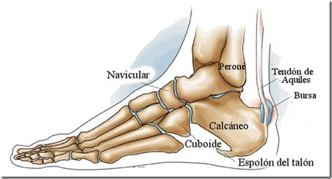 Espolón calcáneo, ¿cómo eliminarlo? - Clínica Rozalén