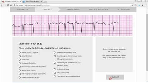 EKG Practice Course 的图像结果