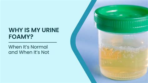 Foamy Urine: Causes, Kidney Signs & When to Worry