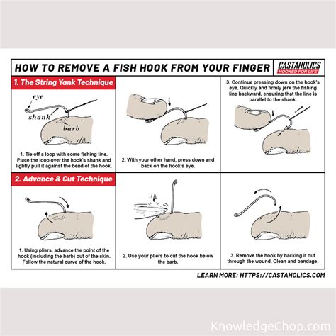 Image result for String Pull Method Fish Hook Removal
