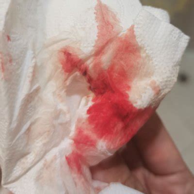 Is this implantation bleeding or period? - Page 4 | BabyCenter