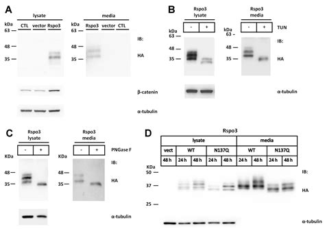 N-Glycosylation of Human R-Spondin 1 Is Required for Efficient ...