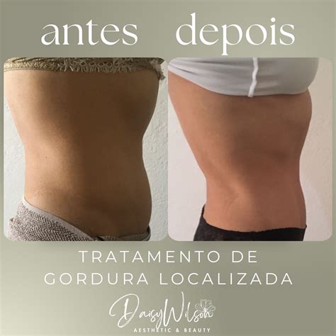 Daiisy Wilson Onlyfans