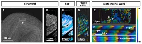 Advances in Imaging Techniques for Mammalian/Human Ciliated Cell’s ...