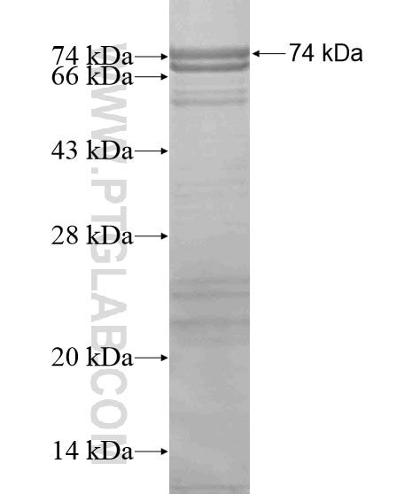 AKAP5 Fusion Protein Ag19162 | Proteintech