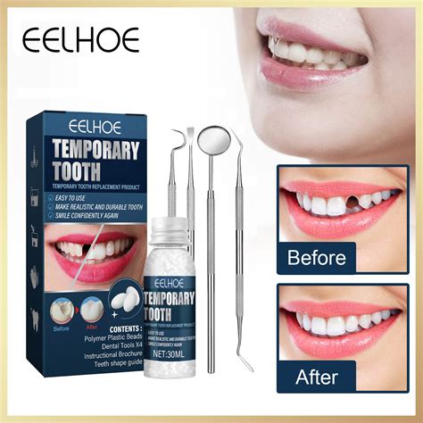 How To Remove Glue From False Teeth at Bruce Conti blog