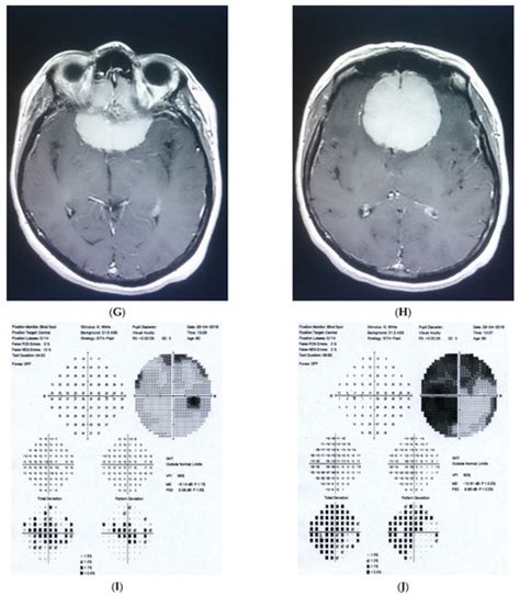 Revisiting the Awareness and Understanding the Associations between ...