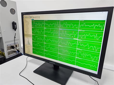 Image result for PROLink Software