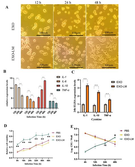 Listeria monocytogenes Modulates Macrophage Inflammatory Responses to ...