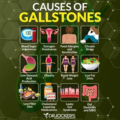 15 natural remedies to get rid of gallstones and foods to eat – Artofit