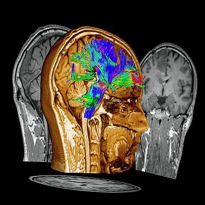 Image result for fMRI Python