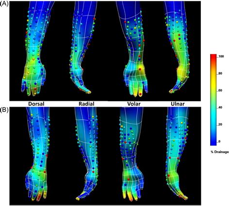 Epitrochlear Lymph Node