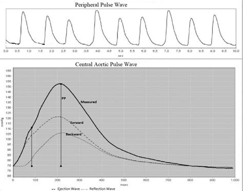 Image result for General Transfer Function Pulse Wave