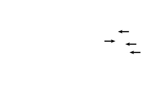 Image result for Modiolus Cochlea