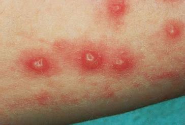 Bildergebnis für effloreszenz