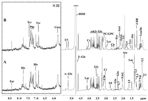 Serum Metabolic Characterization of Vitamin E Deficiency in Holstein ...
