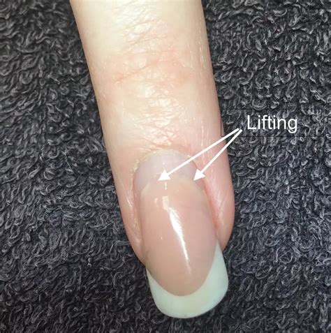 9 oorzaken van lifting van de kunstnagel - NAILED IT | Nagels gel, Acryl nagel ideeën, Perfect ...