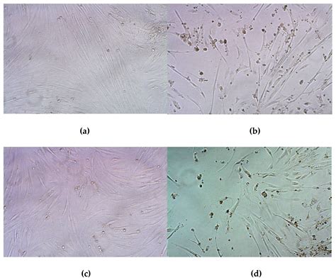 Development of iRGD-Modified Peptide Carriers for Suicide Gene Therapy ...