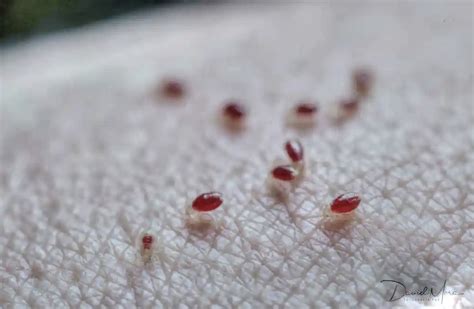 Reportan, otra vez, chinches en Cofepris