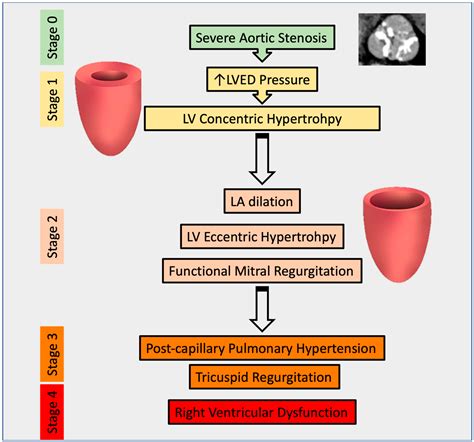 Beyond Aortic Stenosis: Addressing the Challenges of Multivalvular Disease Assessment