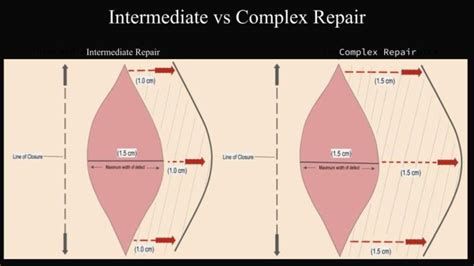 Image result for Complex Repair