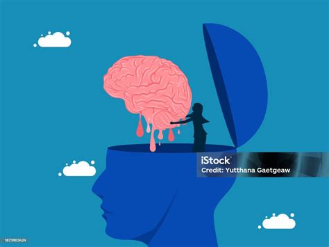 Image result for Brain Decimation