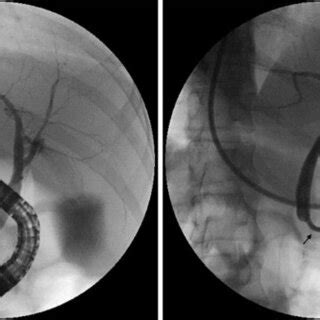 Image result for Prometheus Liver