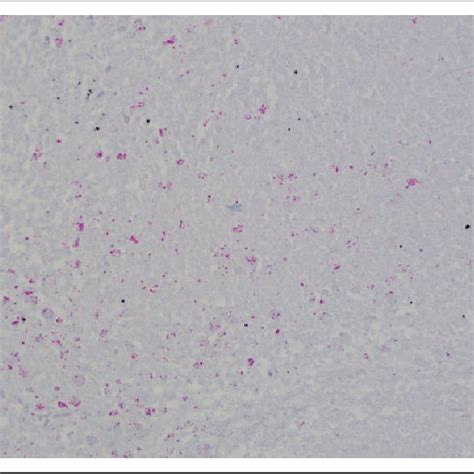 Image result for Acid-Fast Bacilli Staining Method