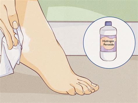 Stinky Feet Causes