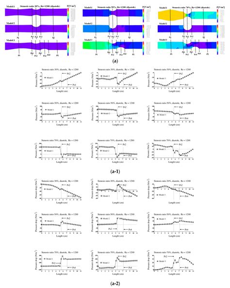 Hemodynamics and Wall Shear Stress of Blood Vessels in Aortic ...