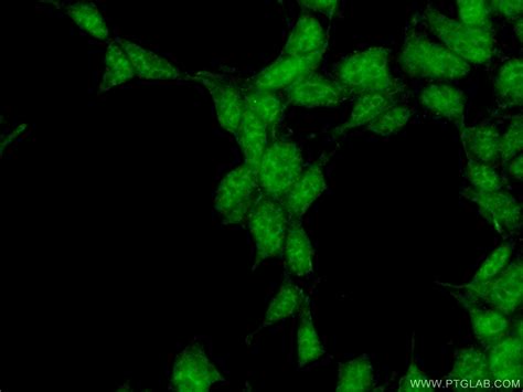 SYF2 antibody (16958-1-AP) | Proteintech