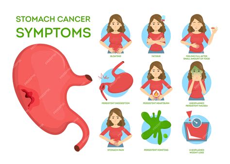 Sintomas De Cancer De Estomago