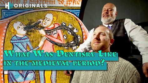 Image result for Medieval Tooth Extraction