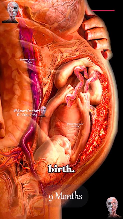 Smart Doctor | 🔊 Tinnitus 🔊 Tinnitus is the perception of noise or ringing in the ears, often ...