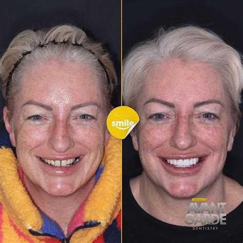 Avant Garde Dentistry on LinkedIn: A 10/10 execution of the Injection ...