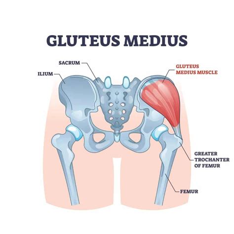 Gluteus Medius Strength and Lower Back Pain | City Baths Spinal and ...