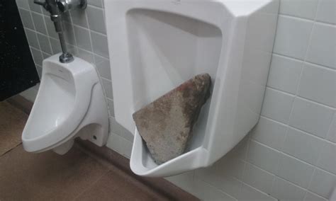 Kidney Stones In Toilet