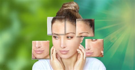 How to repair Sun damaged skin or face naturally? – Nature4Nature