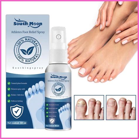 Professional Athletes Foot Spray Natural Anti-Fungi Relief For Inflamed And Itchy Feet 30ml ...