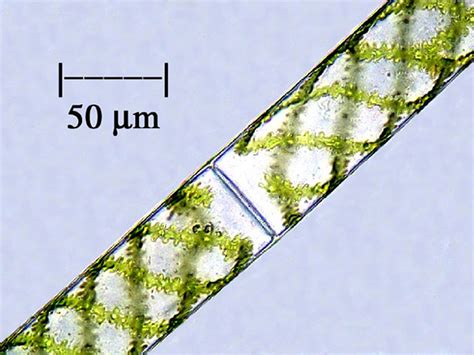 Spirogyra Under Microscope 400x Labeled