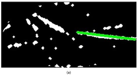 Forearm Intravenous Detection and Localization for Autonomous Vein ...