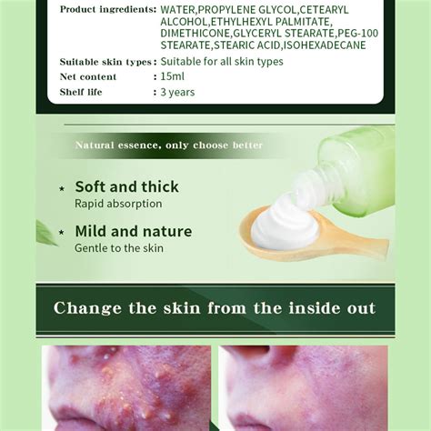 Buy MABREM Repair Acne Cream Extract Acne Removal Scars Marks Treatment ...