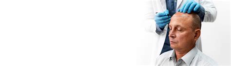 Is Hair Follicle Transplant Right for You? A Comprehensive Guide Based ...