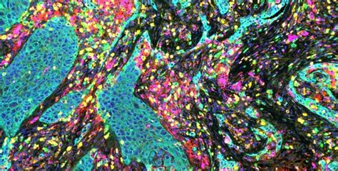 Image result for QuPath Image Analysis