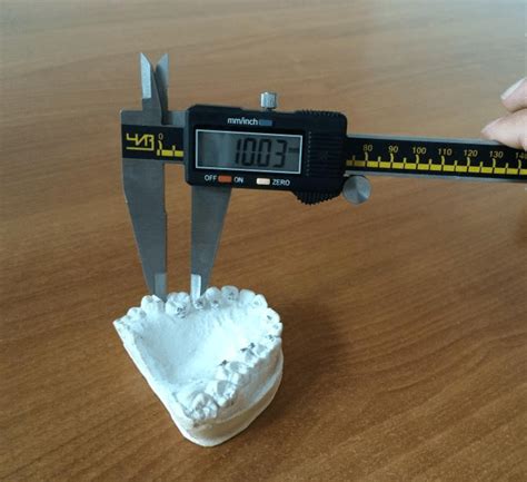 Image result for How to Take Study Models with Plaster Lab