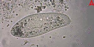 Paramecium Diagram, kingdom, Classification, Structure