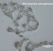 microcystis 的图像结果