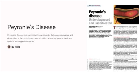 Smoking And Peyronie's Disease at Irene Rayburn blog